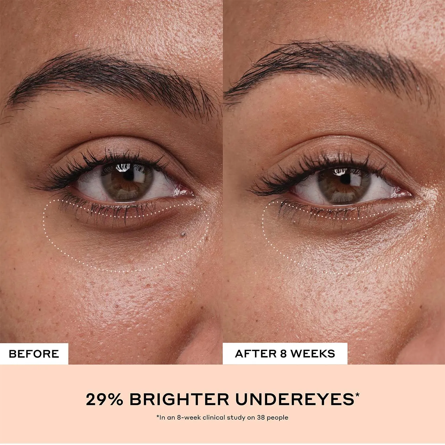 Banana Bright  Eye Crème